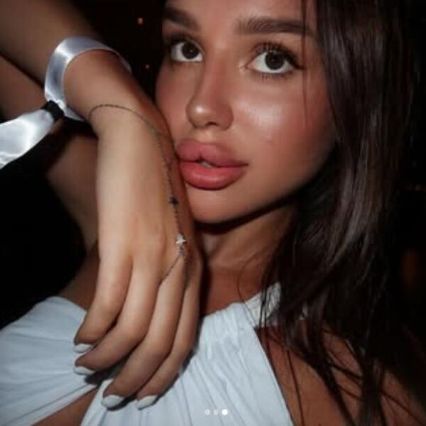 ĆERKA ZDRAVKA ČOLIĆA U ŠOKU NAKON DETONACIJE: Evo u kakvom je stanju Lara, ovaj prizor ledi krv u žilama