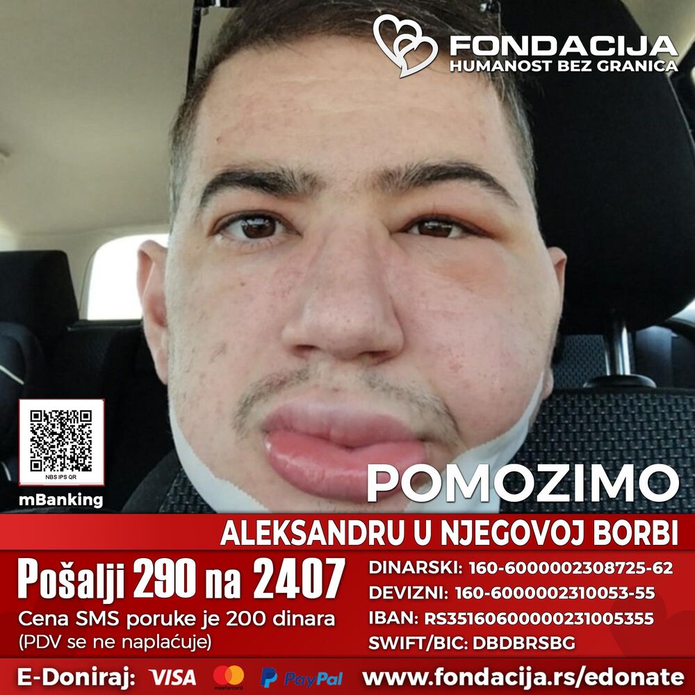 Pomozimo Aleksandru Petroviću - 290 na 2407