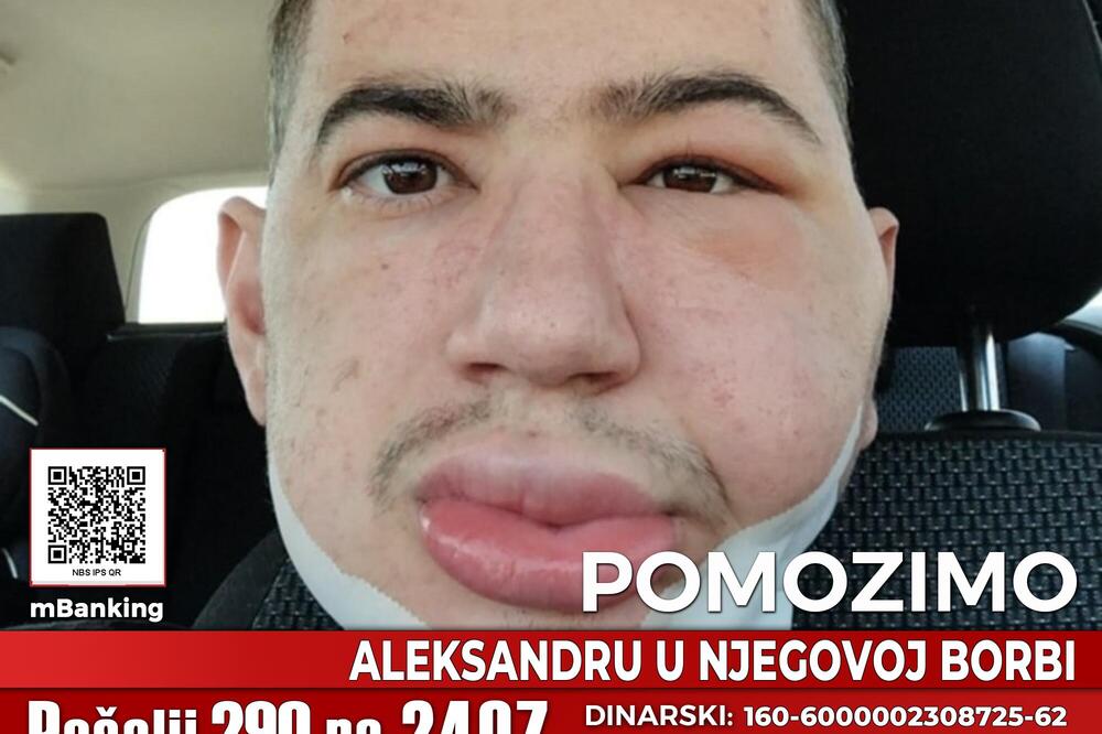 Aleksandar vodi najtežu bitku u životu - ne može sam da je dobije! Pomozimo mu da pobedi opaku bolest (FOTO)