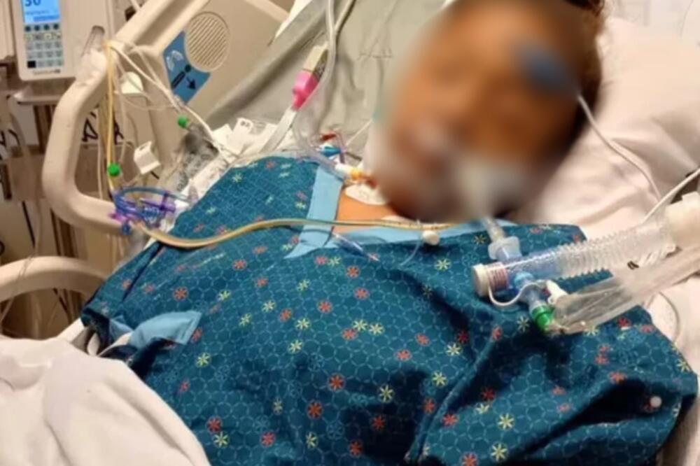 Ženi amputirane obe ruke i noge nakon napada krvoločnog pitbula! Izujedao je do kostiju, i dalje se bori za život!