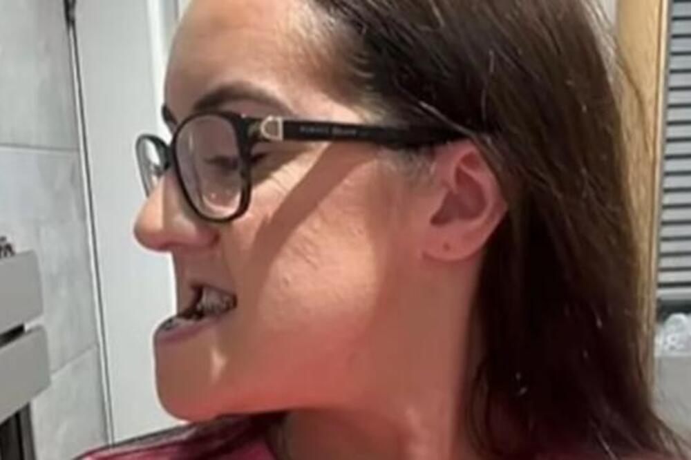 IZGLEDALA KAO DA JE SAMA SEBI BABA! Devojku (26) ni rođena majka ne može da prepozna - VILICA PRAVILA MUKU, A SAD..