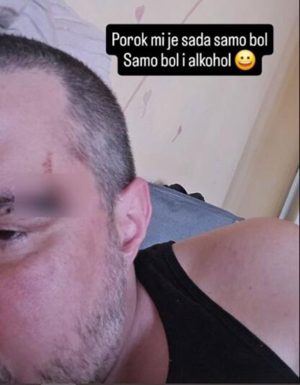 Bojan dobio posekotinu