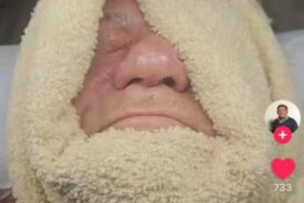 FOLKER (73) NA POLIRANJU! Miloš otišao da zategne lice, pa sredio i PETE - ušao umoran, izašao kao da ide na maturu