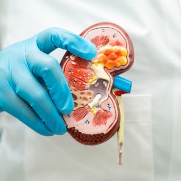 LEKOVI PROTIV BOLOVA UNIŠTAVAJU BUBREGE? Dr Kovačević upozorava Srbe na LOŠU NAVIKU - potrebno je samo 1 KILOGRAM..