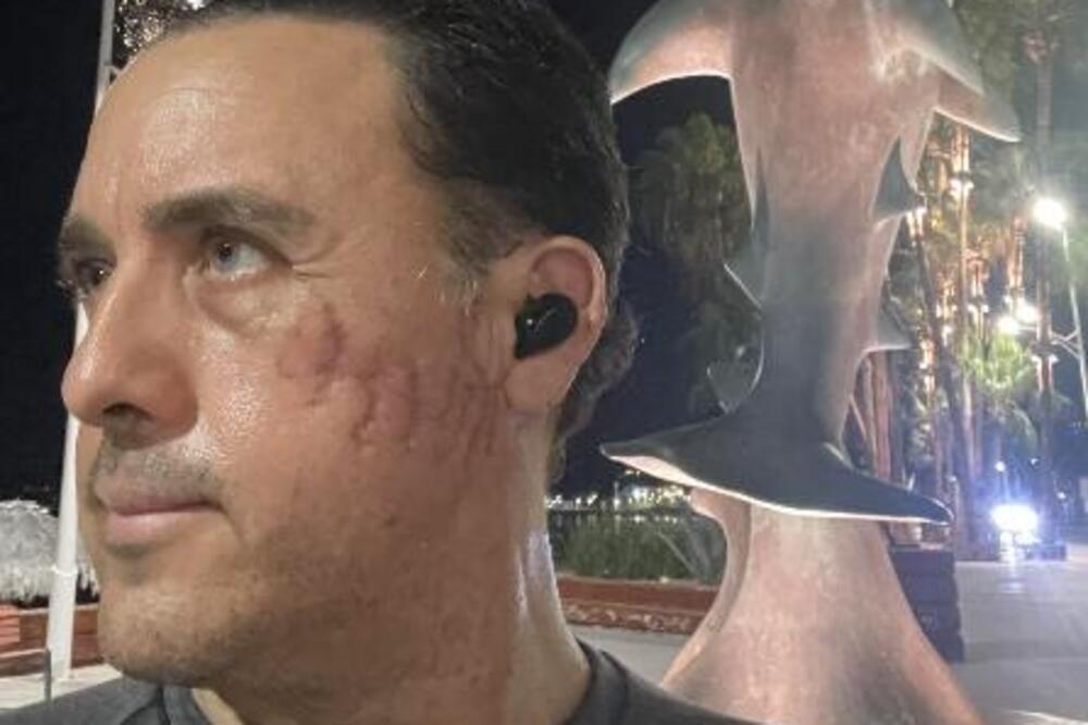 "Kad je zatvorila čeljust, osetio sam pritisak ugriza" Čoveka NAPALA AJKULA, progutala mu glavu, onda počela da...