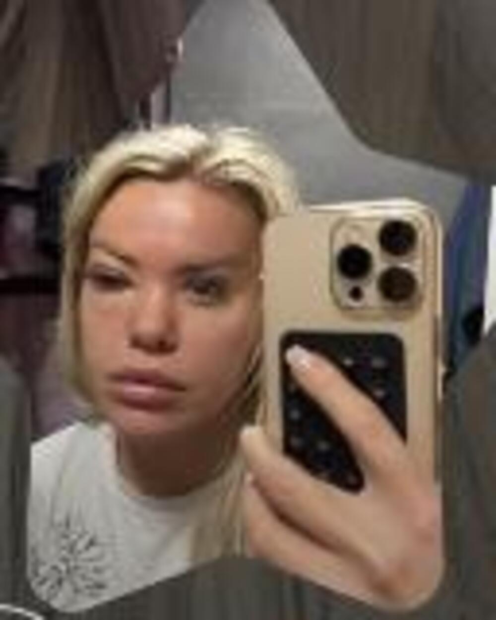 Stavila jaje na oko pa ZAKUKALA! Voditeljka Pinka trpi velike bolove - prizor nije za one sa slabim STOMAKOM