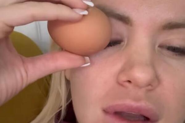 Stavila jaje na oko pa ZAKUKALA! Voditeljka Pinka trpi velike bolove - prizor nije za one sa slabim STOMAKOM