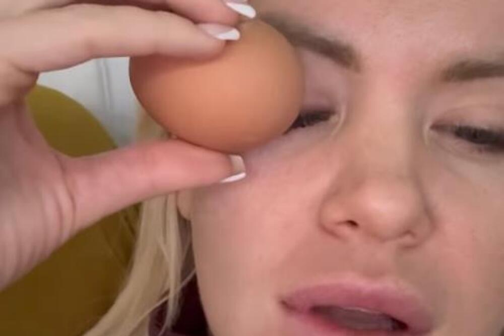 Stavila jaje na oko pa ZAKUKALA! Voditeljka Pinka trpi velike bolove - prizor nije za one sa slabim STOMAKOM