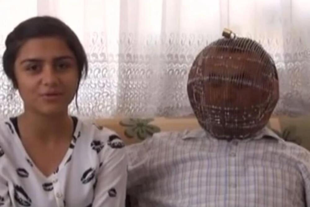 TURČIN STAVIO SKALAMERIJU NA GLAVU I POSTAO GLOBALNA SENZACIJA Zaključao glavu, njegov metod HARA MREŽAMA! (VIDEO)