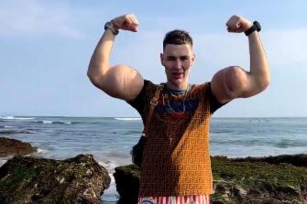 "RUSKI POPAJ" BI MOGAO DA OSTANE BEZ OBE RUKE! Ubrizgavao PETROLEJ KAKO BI IMAO OGROMNE BICEPSE, a sad... (FOTO)