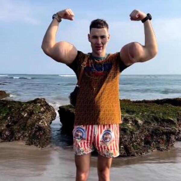 "RUSKI POPAJ" BI MOGAO DA OSTANE BEZ OBE RUKE! Ubrizgavao PETROLEJ KAKO BI IMAO OGROMNE BICEPSE, a sad... (FOTO)