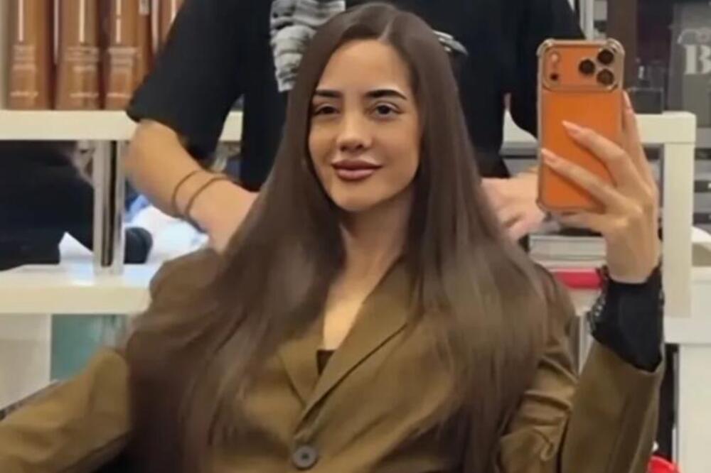 NAKON SNIMKA IZ JAVNOG TOALETA, ANĐELA OBJAVILA NOVI! Niko ne prestaje da gleda u njen NOS, hirurg obavio svoje!