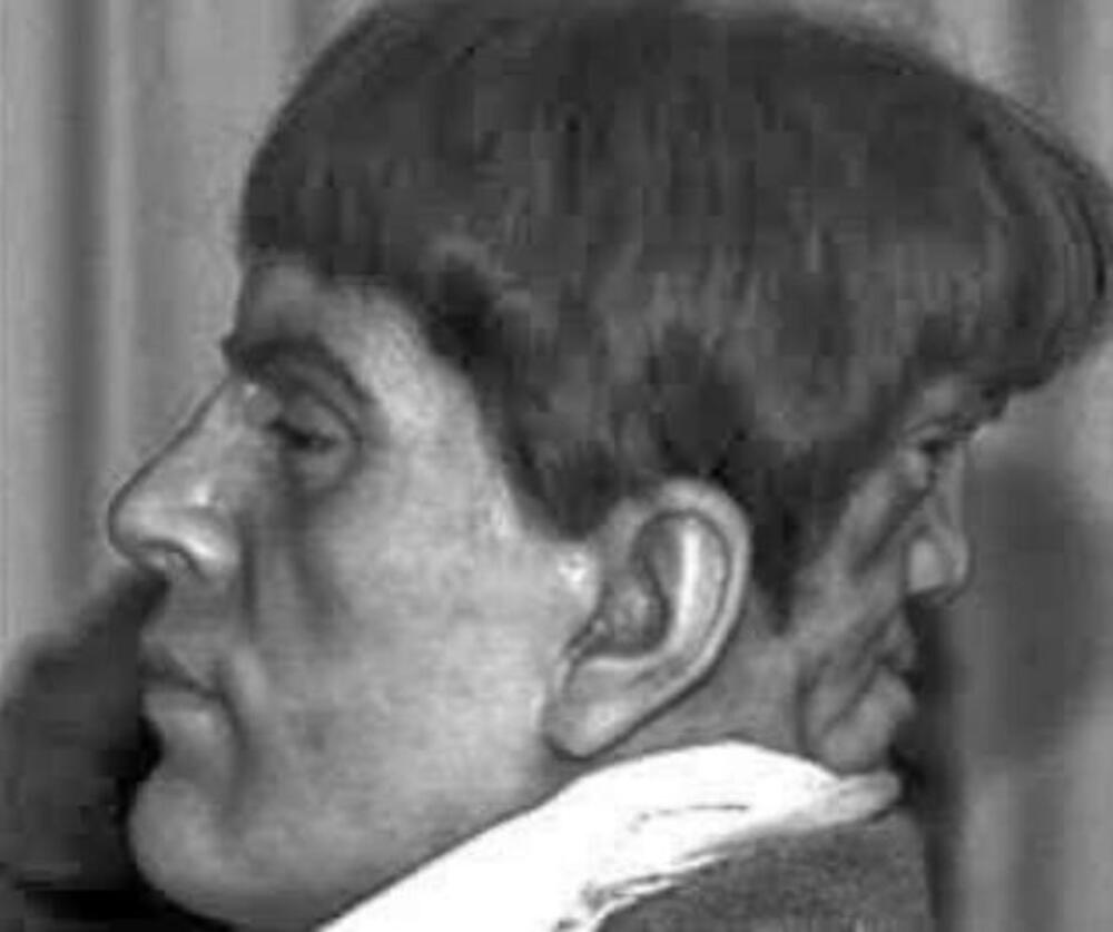 Na potiljku nosio lice "ĐAVOLJEG BLIZANCA" koji ga je terao na morbidne stvari! Šaputao mu grozote, SVE DOK NIJE...