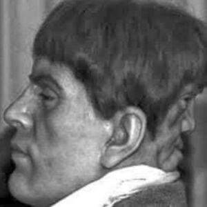 Na potiljku nosio lice "ĐAVOLJEG BLIZANCA" koji ga je terao na morbidne stvari! Šaputao mu grozote, SVE DOK NIJE...