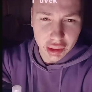 POSLE ANE NIKOLIĆ, I NJEMU LICE ZAVRŠILO U KRASTAMA! Ljudi zgroženi prizorom, UZROK je ovo?