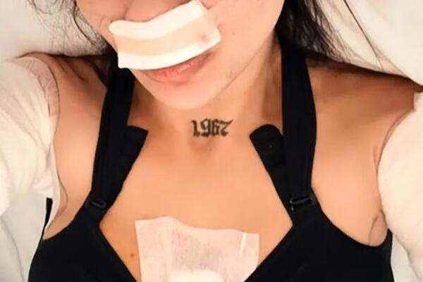 DOKTOR JOJ UNAKAZIO GRUDI I ZALEPIO IH, A ONA HOĆE PO JOŠ! Snimila se pred novu OPERACIJU, biće ih čak...