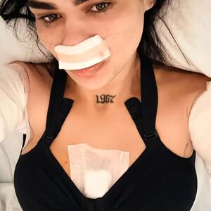 HTELA DA OPERIŠE GRUDI, PA JE DOKTOR UNAKAZIO I ZALEPIO IH! Sad hoće po još, snimak šokira