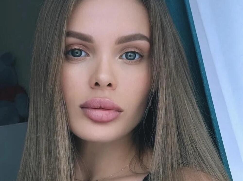 DEČKO ZVERSKI PREBIO ANŽELIKU, GLAVA PUNA HEMATOMA: Hvalila se luksuzom, ali je za to morala da radi OVO dečku!