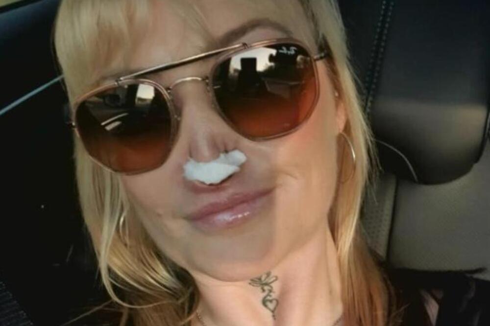 HOROR ISPLIVAO U JAVNOST! Majka dvoje dece (41) kod ZUBARA ostala bez DELA NOSA: Ni anestezija nije delovala, PAKAO