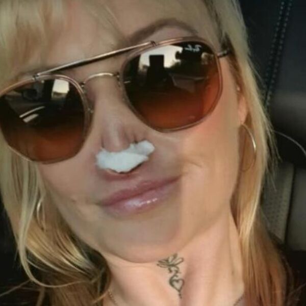 HOROR ISPLIVAO U JAVNOST! Majka dvoje dece (41) kod ZUBARA ostala bez DELA NOSA: Ni anestezija nije delovala, PAKAO