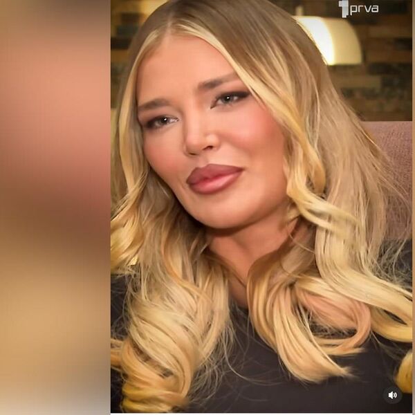 "NE LIČI NA SEBE": NAPADNUTA SOFIJA MILOŠEVIĆ! Tvrde da je BOTOKS uradio svoje, ovo je NOVO LICE