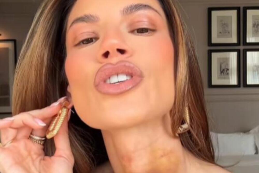 KAKVI SU JOJ OVO PODLIVI? Ognjenova bivša htela da pokaže MINIĆ, umesto njega sevnule MODRICE!