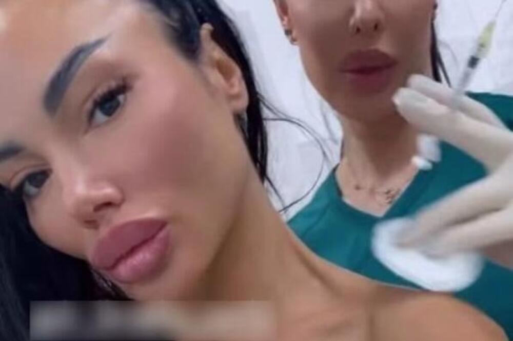 "KO NEMA VRAT NEKA...": Starleta uradila 100 operacija, a sad se BODE I NA OVOM MESTU! Prizor zgranuo Srbe