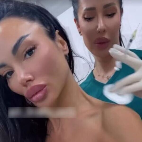 "KO NEMA VRAT NEKA...": Starleta uradila 100 operacija, a sad se BODE I NA OVOM MESTU! Prizor zgranuo Srbe