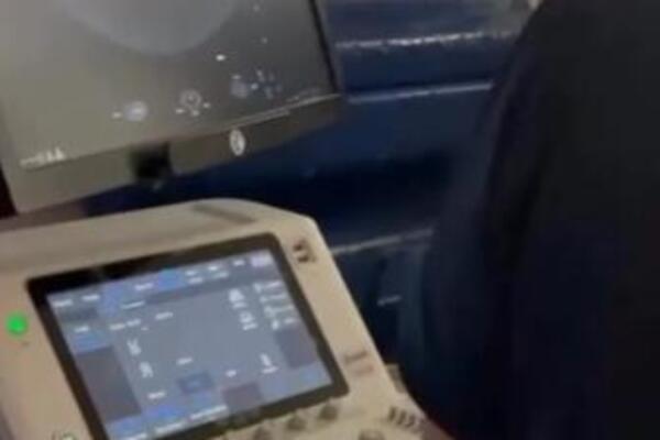 OSVANUO ULTRAZVUK BEBE MILICE MITROVIĆ! Nacija nikad srećnija zbog PRINOVE - evo kako izgleda!