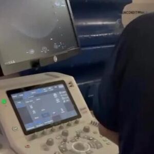 OSVANUO ULTRAZVUK BEBE MILICE MITROVIĆ! Nacija nikad srećnija zbog PRINOVE - evo kako izgleda!