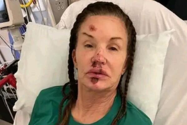 TRAJNO UNAKAŽENA? U Jugoslaviji je OBOŽAVALI, a sad je ne bi prepoznali - LICE JOJ UNIŠTENO, HIRURZI BESPOMOĆNI