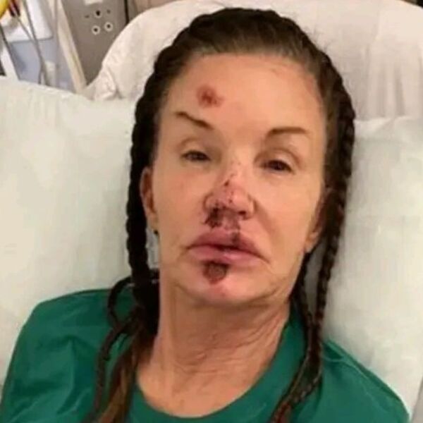 TRAJNO UNAKAŽENA? U Jugoslaviji je OBOŽAVALI, a sad je ne bi prepoznali - LICE JOJ UNIŠTENO, HIRURZI BESPOMOĆNI