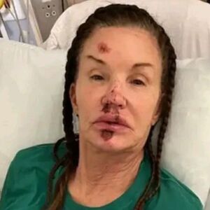 TRAJNO UNAKAŽENA? U Jugoslaviji je OBOŽAVALI, a sad je ne bi prepoznali - LICE JOJ UNIŠTENO, HIRURZI BESPOMOĆNI