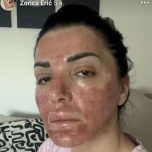 KUKU MAJKO! Pevačica cela UMRLJANA KRVLJU, nimalo ne liči na sebe! Slika koja kruži je UZNEMIRUJUĆA