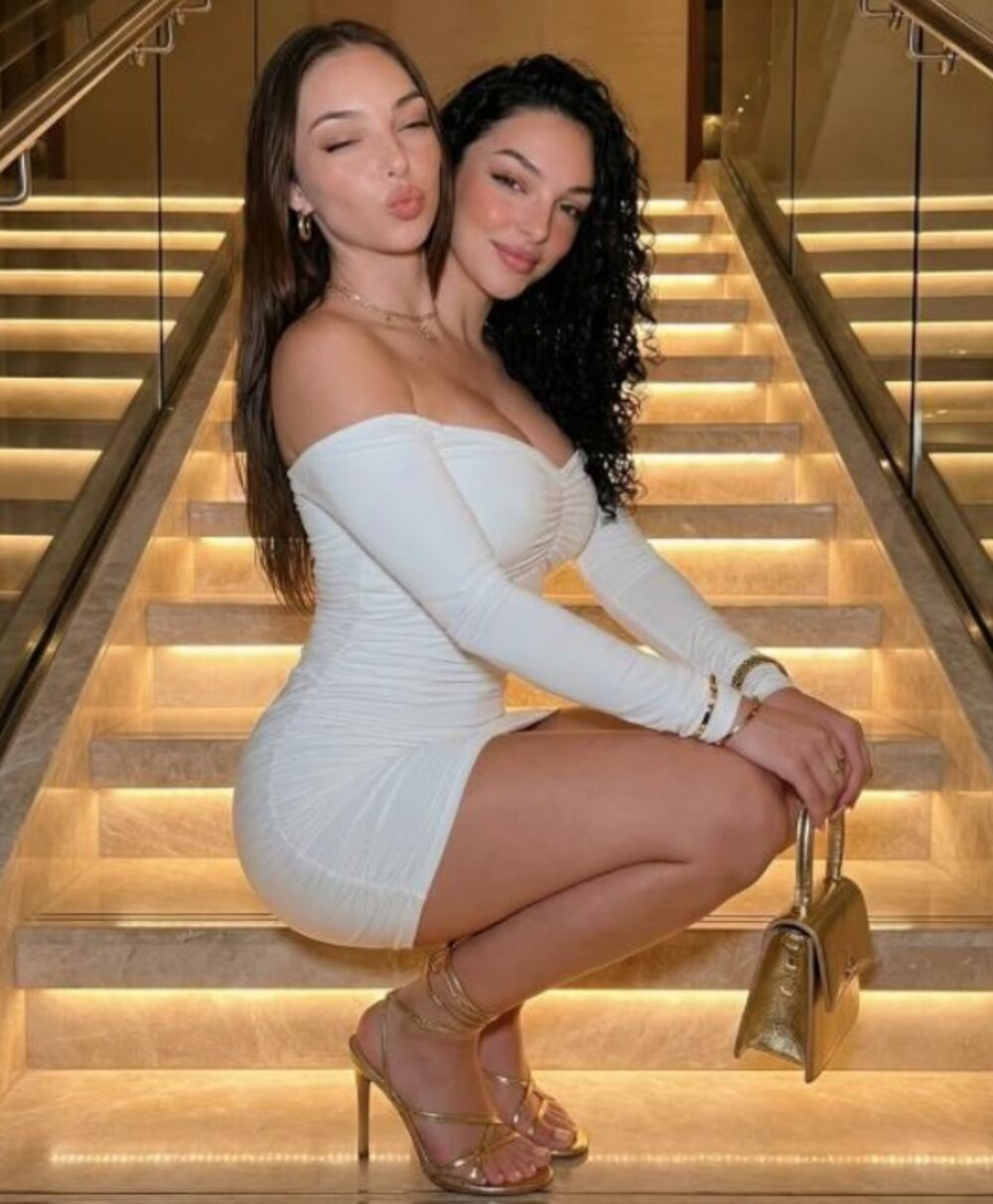 Sijamske bliznakinje