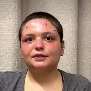 Preživela žrtva požara u Švajcarskoj opisala detalje horora: "Videla sam šta je držala u rukama" (VIDEO)