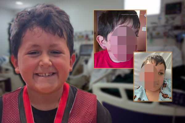 DEČAK ZADOBIO STRAVIČNE OPEKOTINE ZBOG NOVOG TIK TOK TRENDA SA OVOM IGRAČKOM: Lekari ostali u ŠOKU! (FOTO)