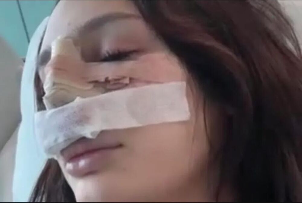 Nina nakon operacije