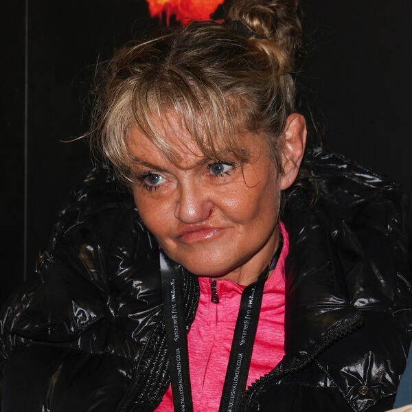 KAD VAS RAZORI LOŠ IZBOR! Danijela ima 52 godine i TRULO lice, Srbi je ne pamte ovakvu... KOKA JE BUKVALNO POJELA