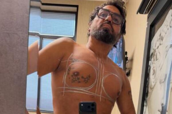 ŠOK! Bugarski pevač UGRADIO SILIKONE od 600 kubika! SLIKE GRUDI izazvale nevericu - "LEPO ĆE SESTI"