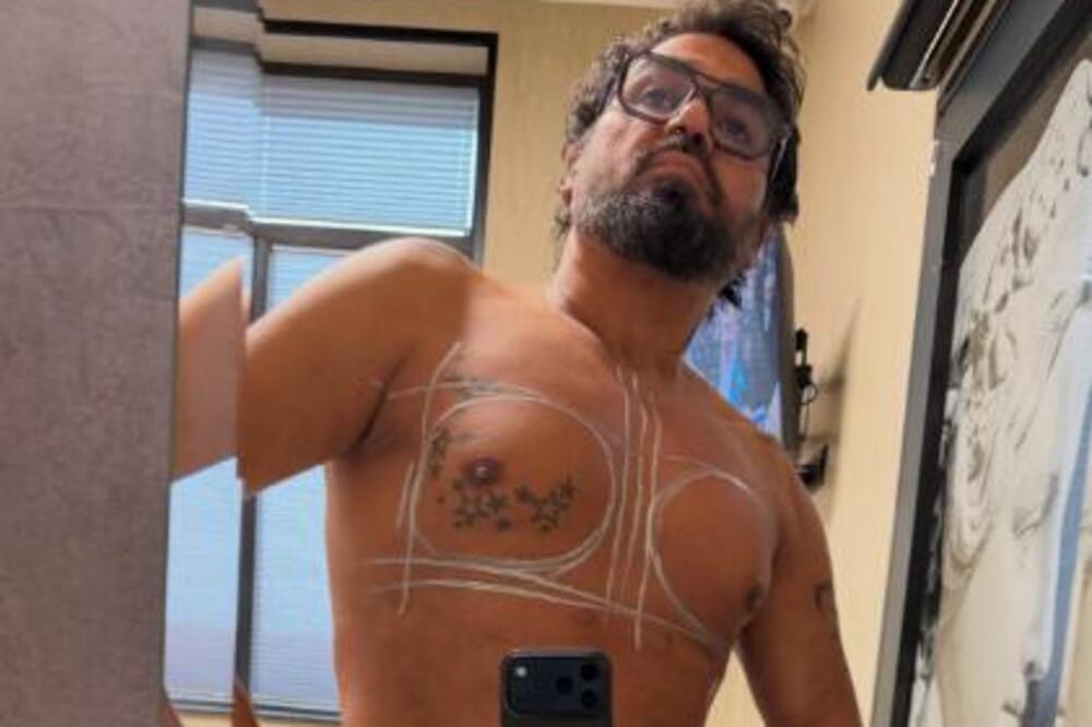 ŠOK! Bugarski pevač UGRADIO SILIKONE od 600 kubika! SLIKE GRUDI izazvale nevericu - "LEPO ĆE SESTI"