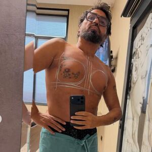 ŠOK! Bugarski pevač UGRADIO SILIKONE od 600 kubika! SLIKE GRUDI izazvale nevericu - "LEPO ĆE SESTI"