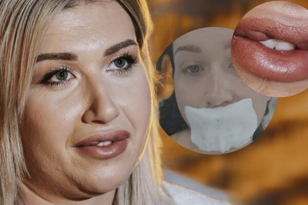 NATAŠA UPOZORAVA SRPKINJE - NE ŽELITE DA PROĐETE KAO ONA! Samo je OPERACIJOM mogla da sredi DEFORMISANA USTA