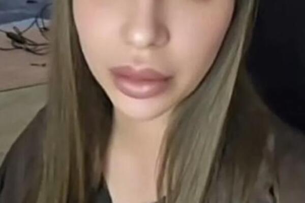 MILJO, TI LI SI? KULIĆKA SNIMILA KAKO IZGLEDA POSLE PRIMANJA TERAPIJE! Prekršila 1 stvar, ŠTA LI ĆE REĆI LEKARI