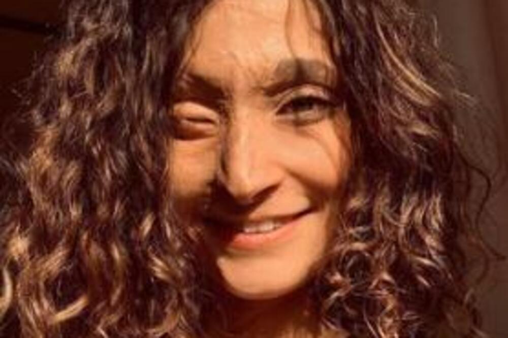 Lepoj Iranki bacili KISELINU U LICE zbog ovoga! Ono što je kasnije doživela PEKLO JU JE VIŠE OD ŽIVIH RANA! (FOTO)