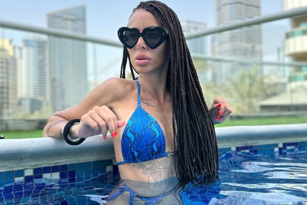 TAMARA REŠILA DRASTIČNO DA POVEĆA GRUDI: Bićete u neverici koliko kubika ima sada, ovako izgleda nakon operacije