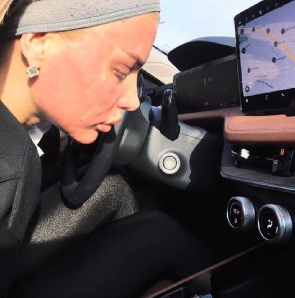 UNIŠTENO LICE VODITELJKE PINKA! Ožijci joj izmenili LIČNI OPIS, prizor će vas UZNEMIRITI - SAD JE NEPREPOZNATLJIVA