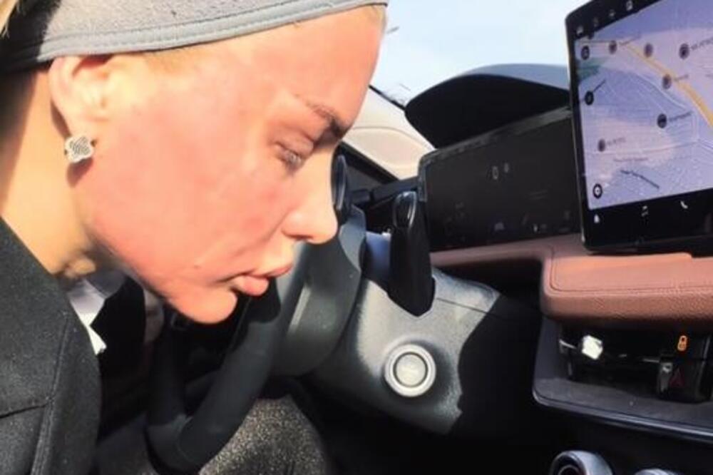 UNIŠTENO LICE VODITELJKE PINKA! Ožijci joj izmenili LIČNI OPIS, prizor će vas UZNEMIRITI - SAD JE NEPREPOZNATLJIVA