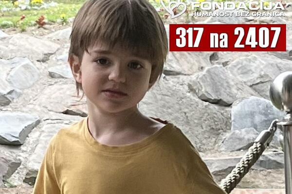 MALI MIHAILO IZ BEOGRADA MORA HITNO NA LEČENJE! Pomozimo mu da dobije ŠTO KVALITETNIJE DETINJSTVO koje ZASLUŽUJE!