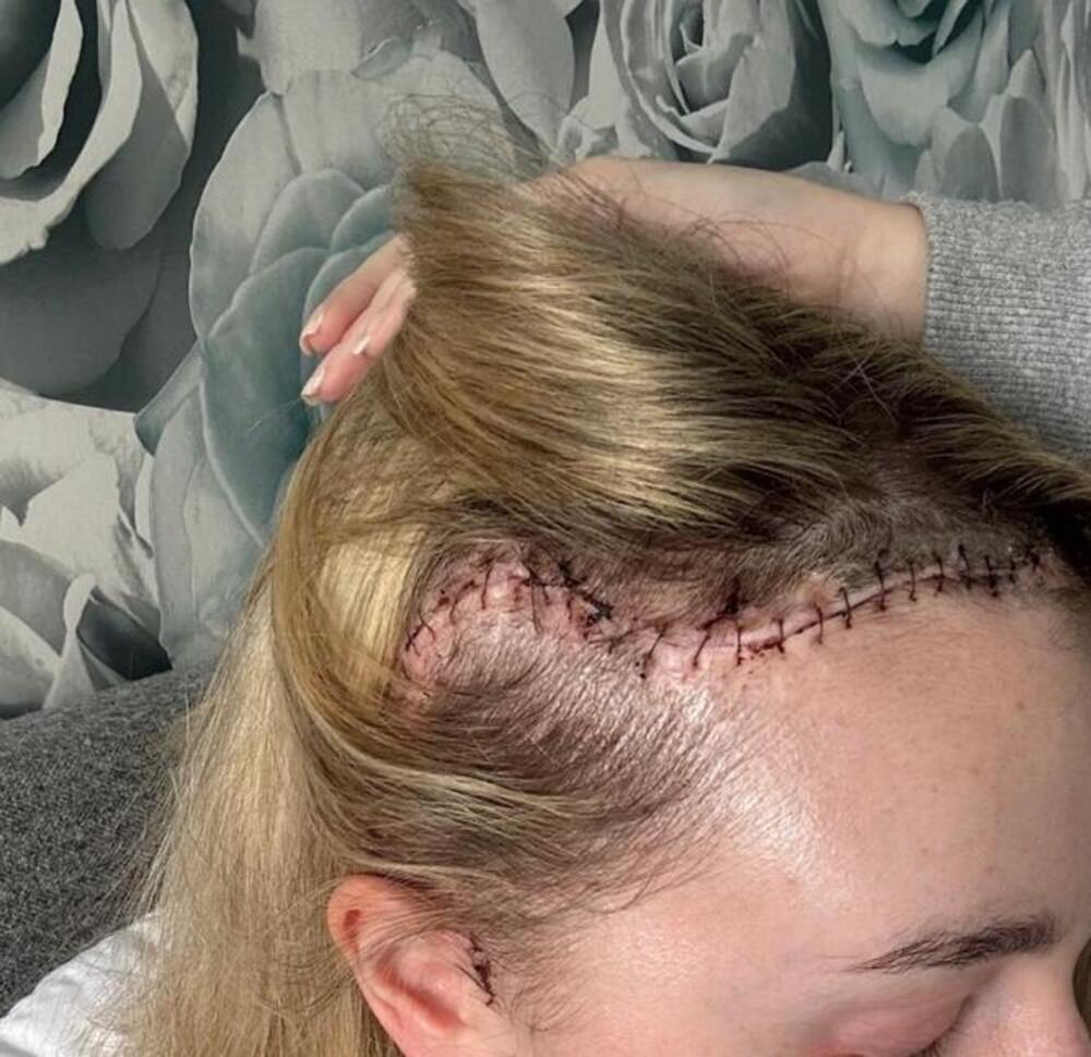 "BIO JE VELIČINE GREJPA": Otišla kod oftamologa, pa je sačekala HOROR VEST! U njoj se krila TEMPIRANA BOMBA